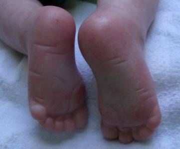 Feet