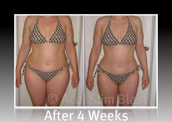 The premise adele weight loss bikini pictures Patients adele weight loss bikini pictures ask for further