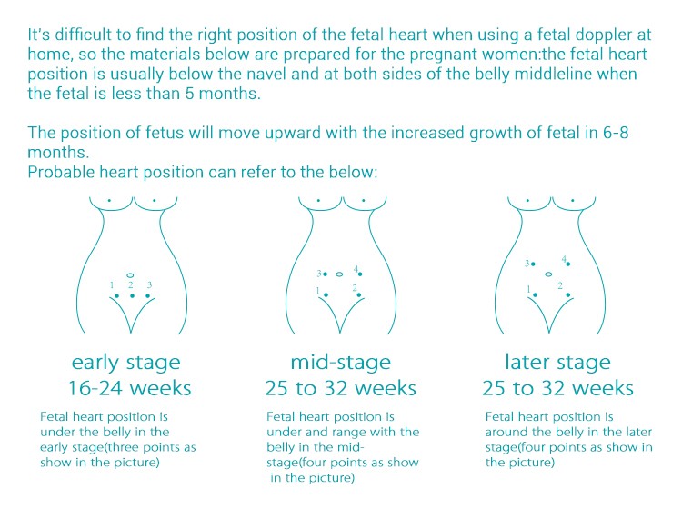 fetal heart monitor doppler