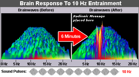 brainwaves before and after 10Hz entrainment