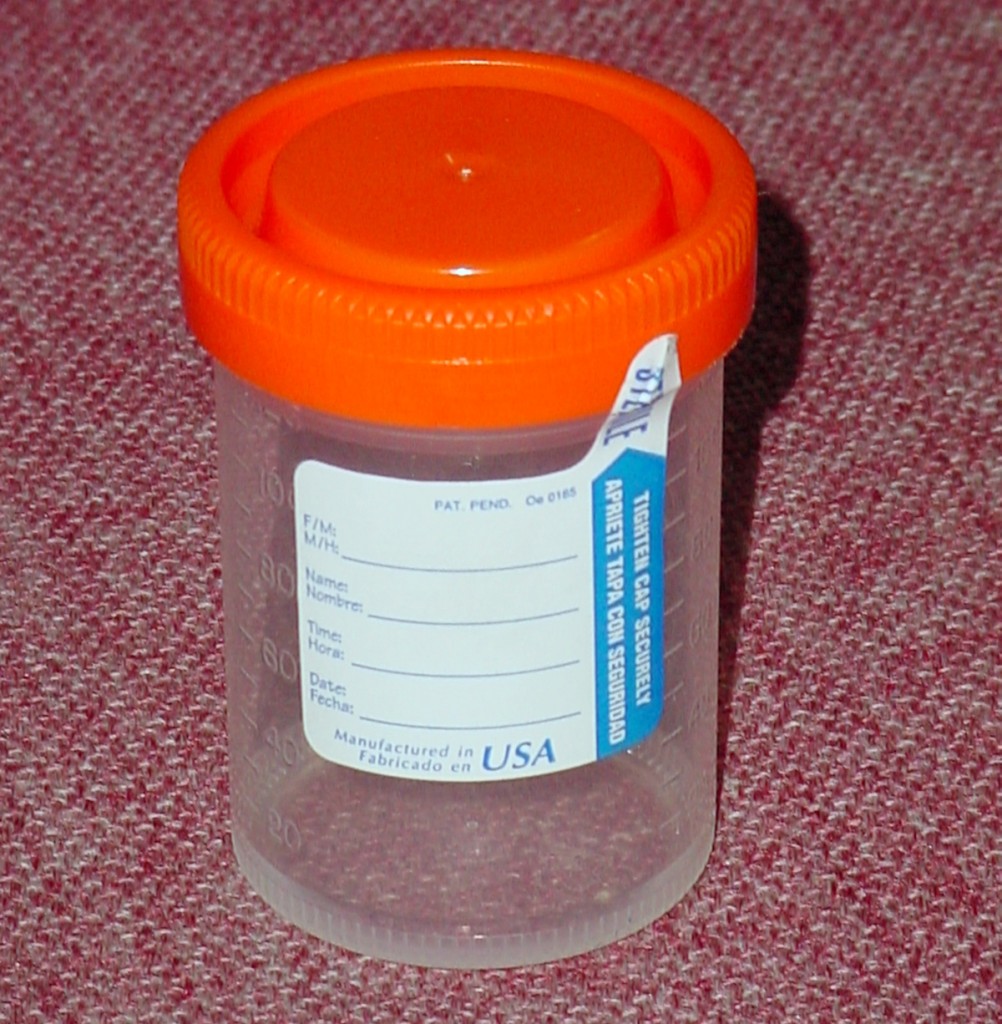 What Is A Sterile Urine Specimen