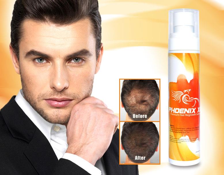 hairloss blocker depoimentos