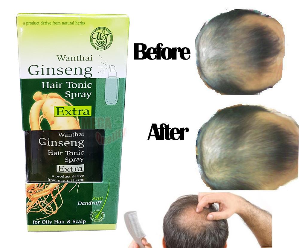 Wanthai Ginseng Hair Tonic Spray Extra For Oily Hair Scalp Anti Dandruff 100ml Ebay