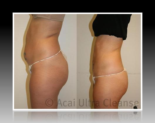 Lose weight slowly and keep it off picture 7