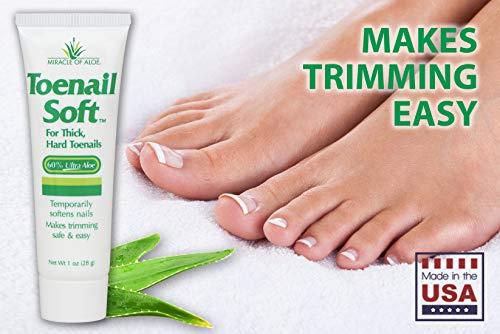 cream toenails