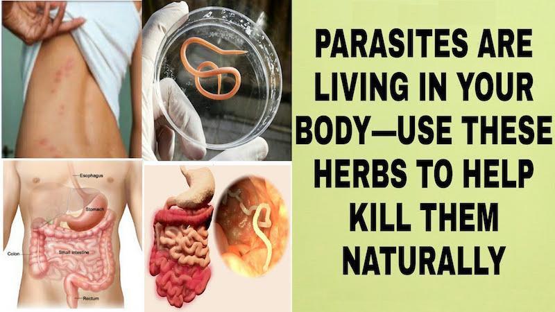 Get Rid Of Parasites In Humans Naturally لم يسبق له مثيل الصور